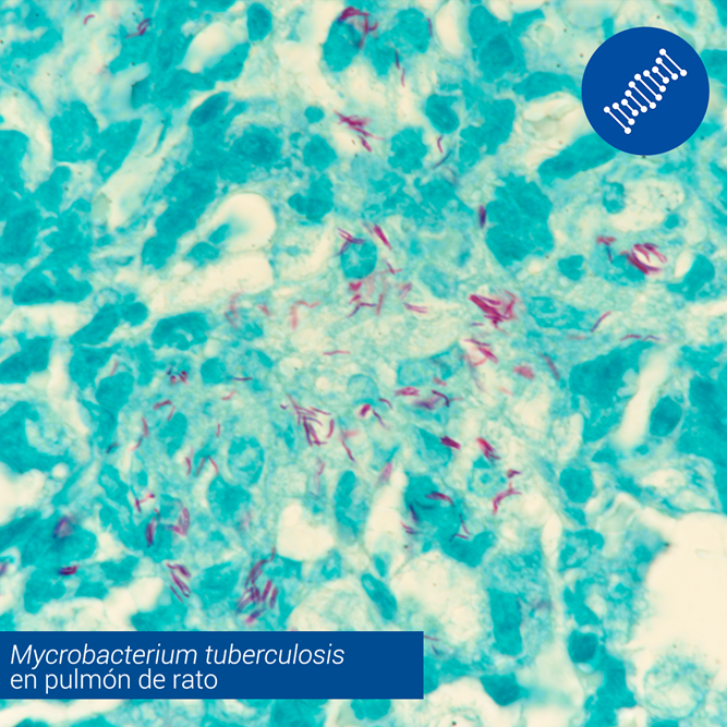 Mycrobacterium Tuberculosis En Pulmón De Rato