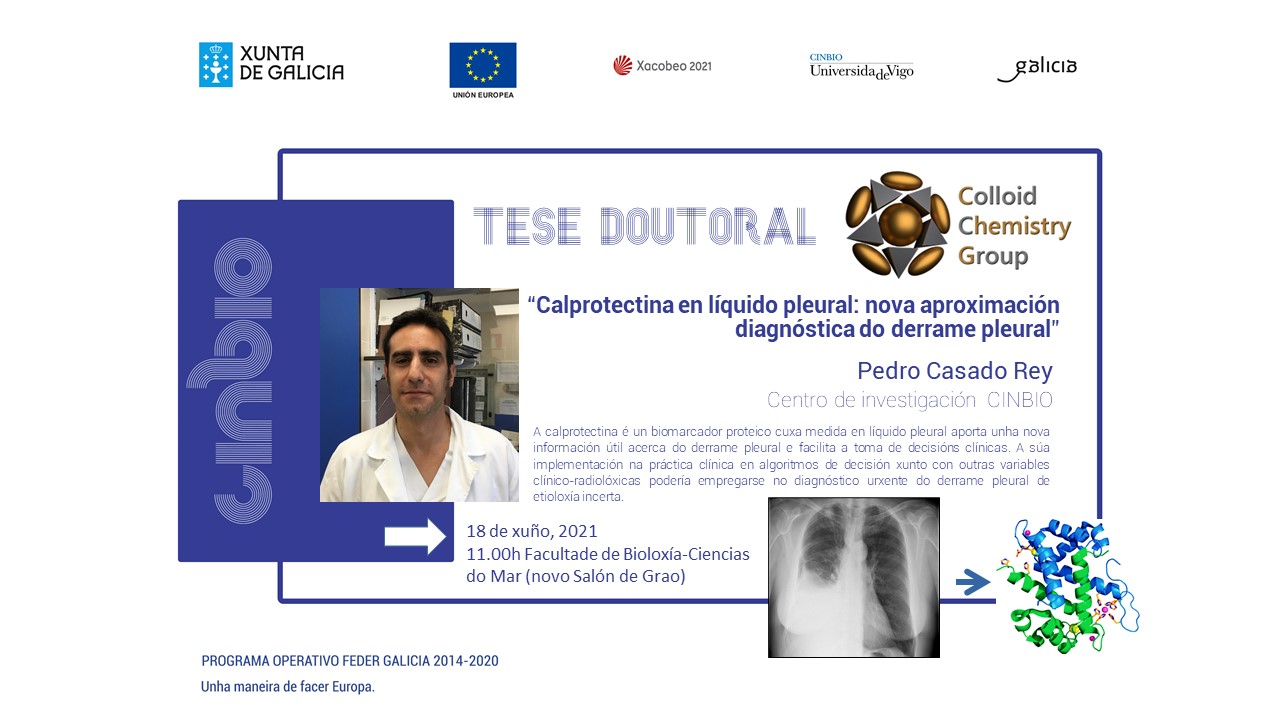 Tese doutoral: Pedro Casado Rey